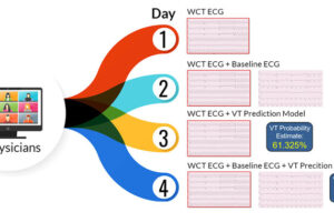Wide Complex Tachycardia Discrimination Tool Improves Physician’s Diagnostic Accuracy