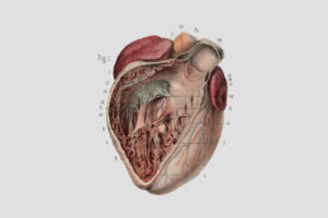 A HISTORY OF HEART FAILURE—AND RECOVERY
