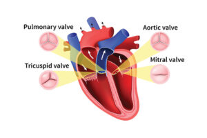 Evolution of Heart Valve Repair