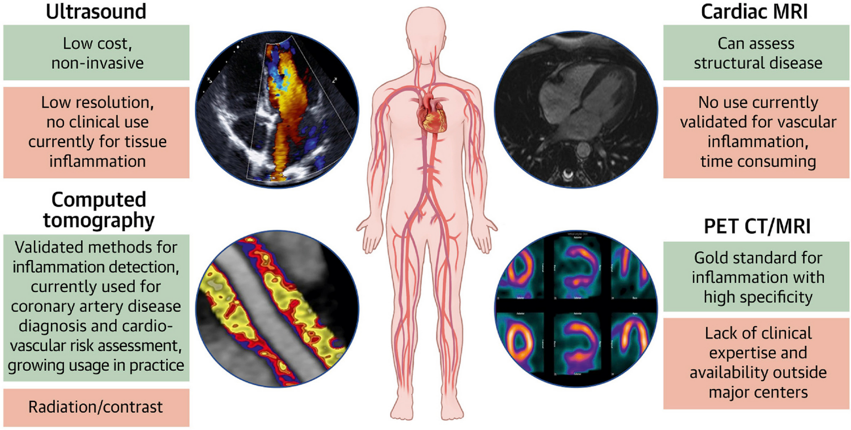 prabhu-coauthors-acc-scientific-statement-on-inflammation-and