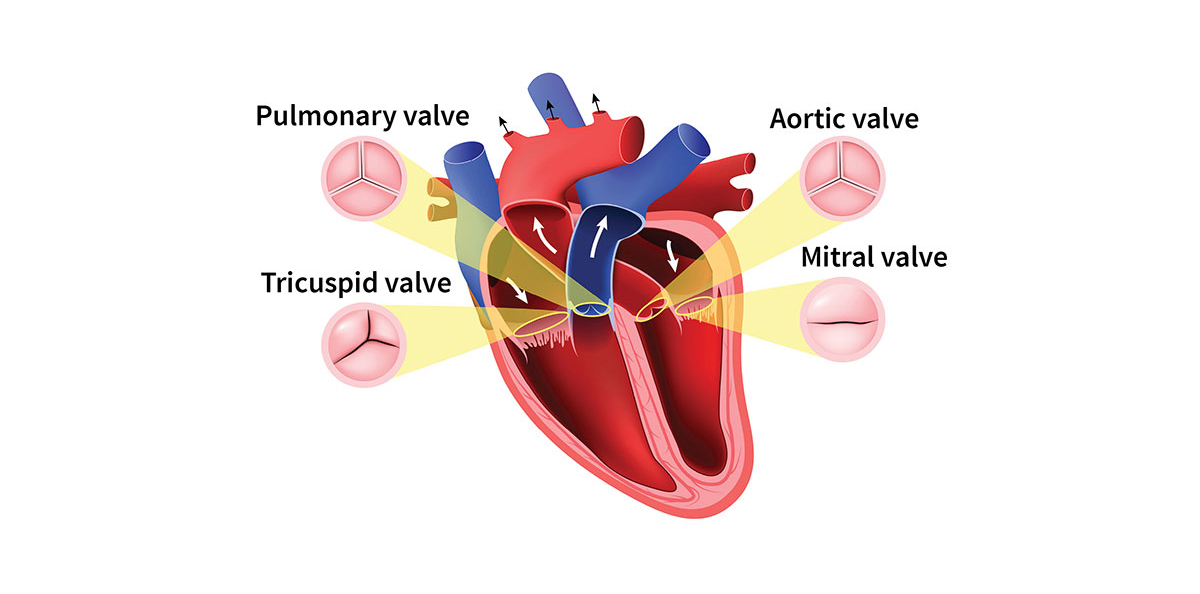 Evolution of Heart Valve Repair