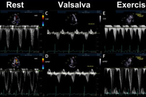 Husaini, Bach, and Cresci Publish Clinical Case in JACC